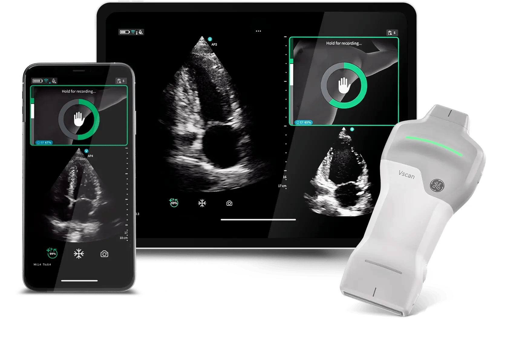 caption-ai-section-light-grey-scan-with-confidence