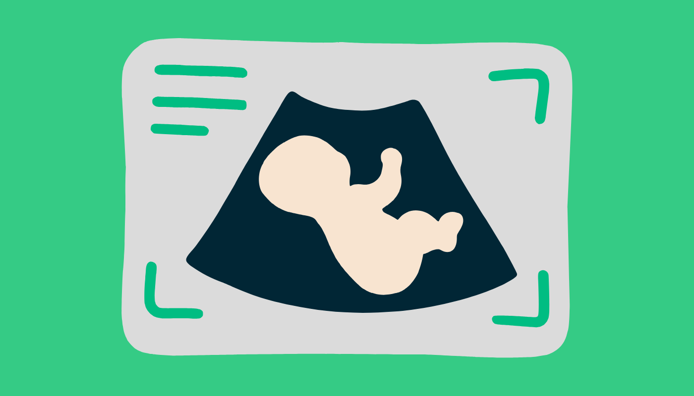 <span id="hs_cos_wrapper_name" class="hs_cos_wrapper hs_cos_wrapper_meta_field hs_cos_wrapper_type_text" style="" data-hs-cos-general-type="meta_field" data-hs-cos-type="text" >Comment choisir un échographe médical en 2026 (guide complet)</span>